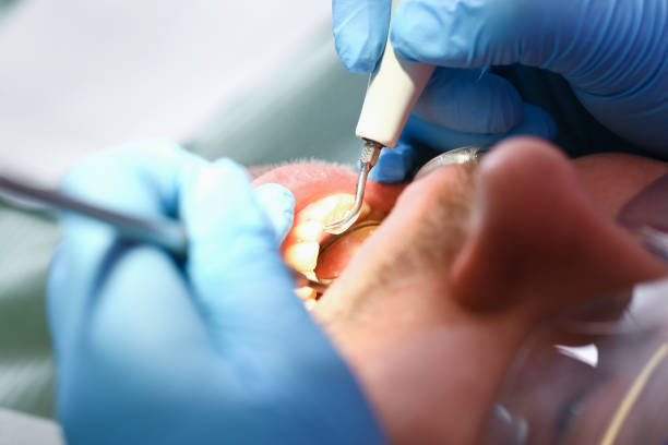Best Emergency Orthodontic Repairs in Butler, MO